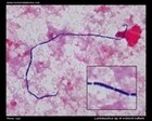 lactobacilli in hemoculture